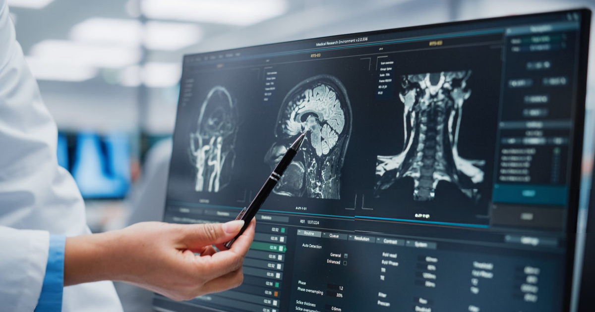 World Brain Tumour Day 2025: Awareness and Practical Prevention Tips